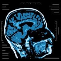 neurofeedback