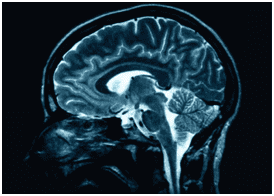 the brain
